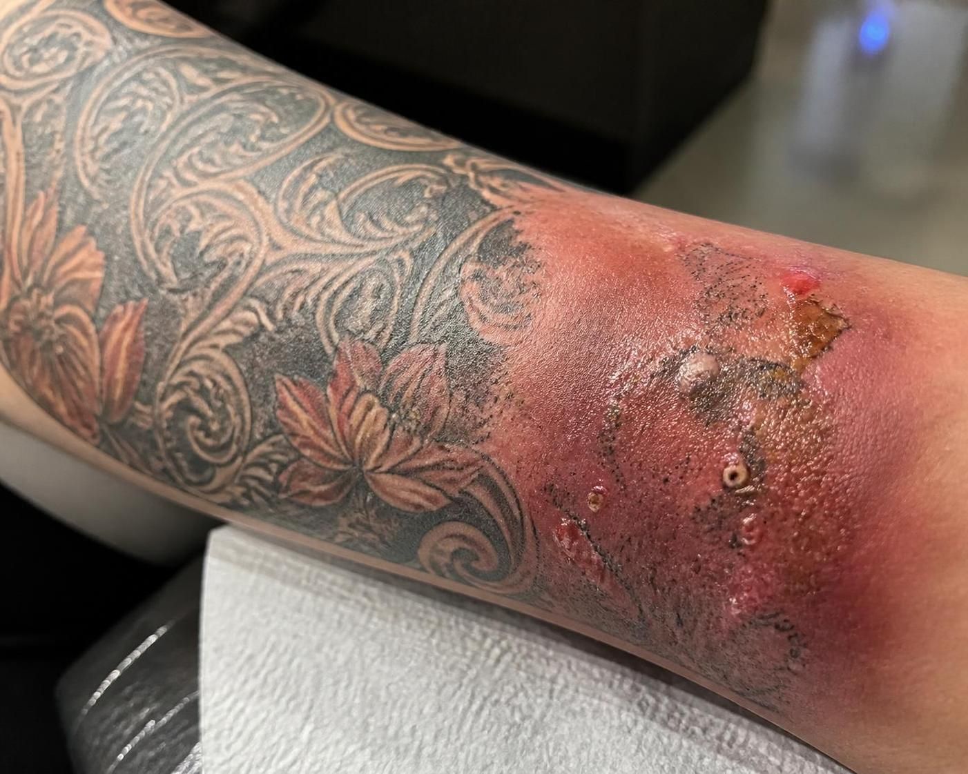 découvrez les signes d'un tatouage infecté pour agir rapidement et éviter les complications. apprenez à reconnaître les symptômes alarmants et les bonnes pratiques de soin.