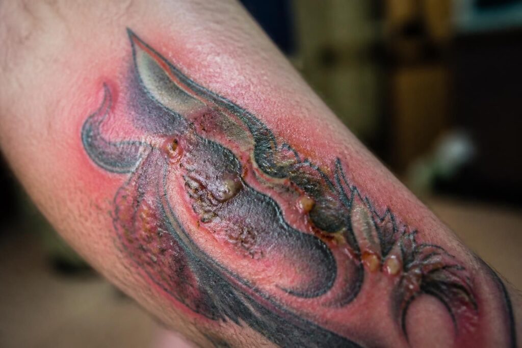 découvrez les signes d'un tatouage infecté pour agir rapidement et éviter les complications. apprenez à reconnaître les symptômes à surveiller après votre tatouage.